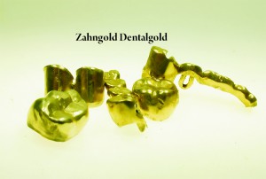 Zahngold Dentalgold ankauf