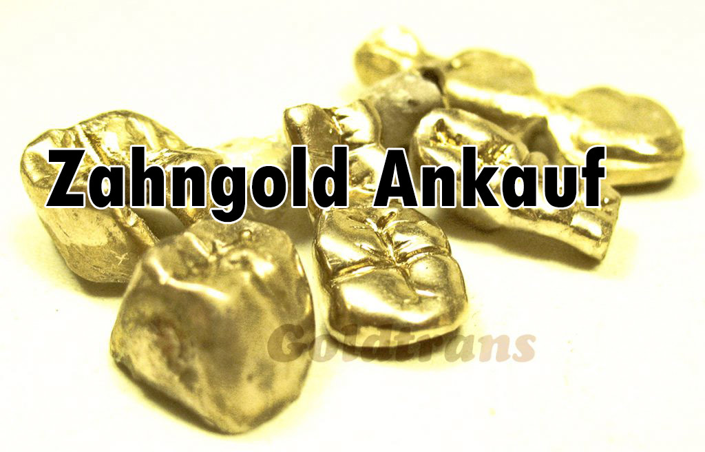 Zahngold ankauf